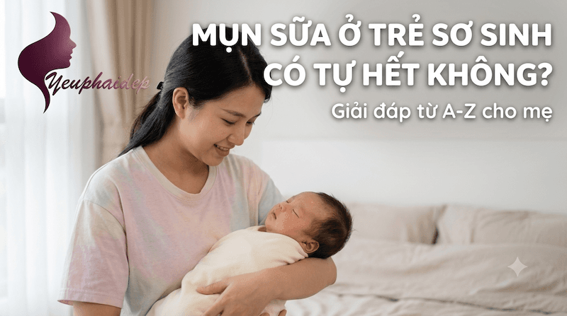Mụn sữa ở trẻ sơ sinh có tự hết không? Giải đáp từ A-Z cho mẹ