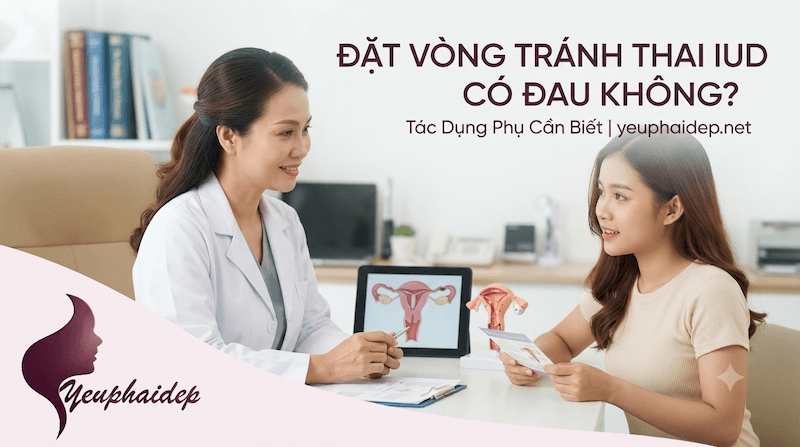 Đặt Vòng Tránh Thai IUD Có Đau Không? Tác Dụng Phụ Cần Biết