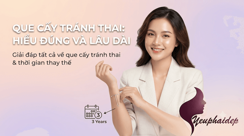 Que Cấy Tránh Thai Là Gì? Bao Lâu Thay Một Lần?