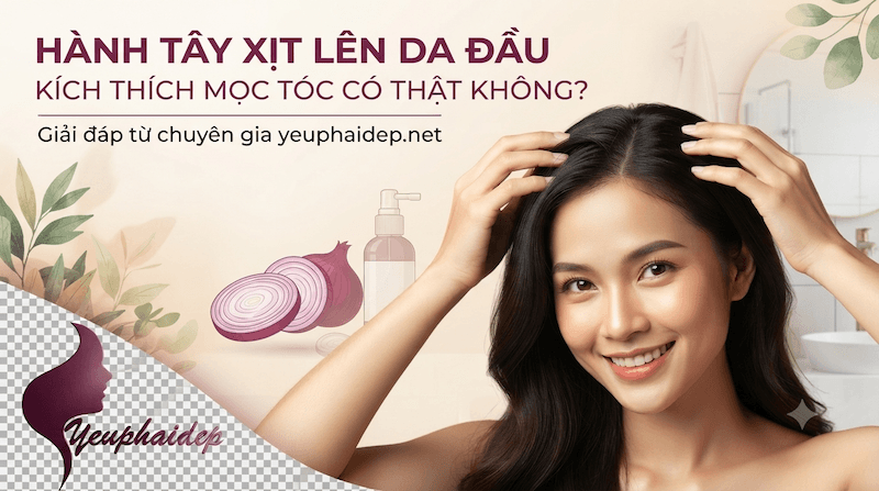 Hành Tây Xịt Lên Da Đầu Kích Thích Mọc Tóc Có Thật Không?