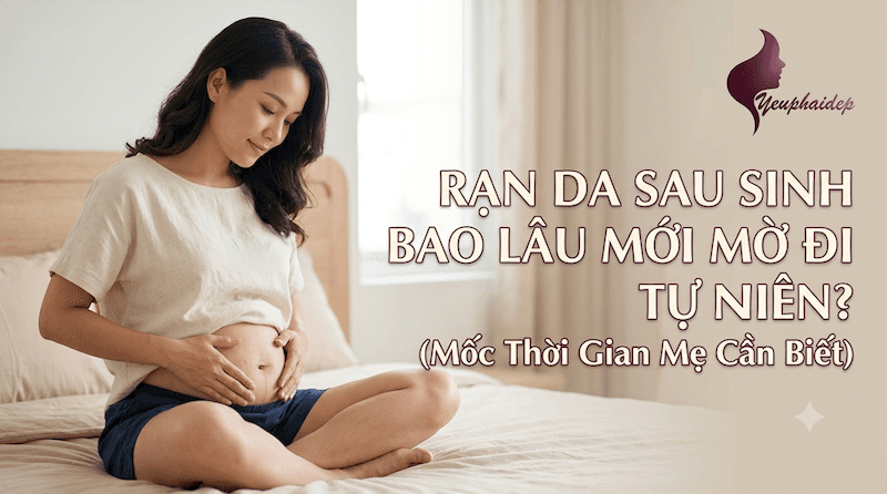 Rạn Da Sau Sinh Bao Lâu Mới Mờ Đi Tự Nhiên? Mốc Thời Gian Mẹ Cần Biết
