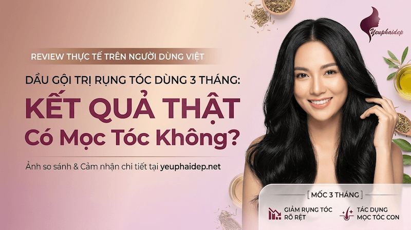 Dầu Gội Trị Rụng Tóc Dùng 3 Tháng: Kết Quả Thật Có Mọc Tóc Không?